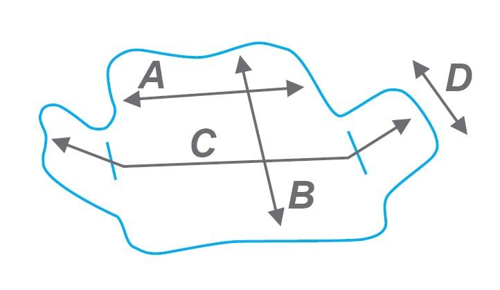 Функционально-корригирующий корсет (размер XL) STABILO CONFORTABLE PLUS Noel купить в OrtoMir24
